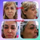 Slider image (6) NES Regenerative Medicine Clinic